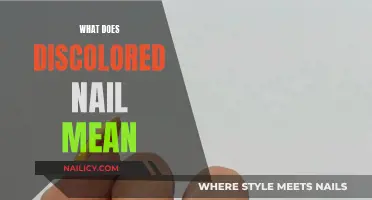 Nail Discoloration: What Your Nails Are Trying to Tell You