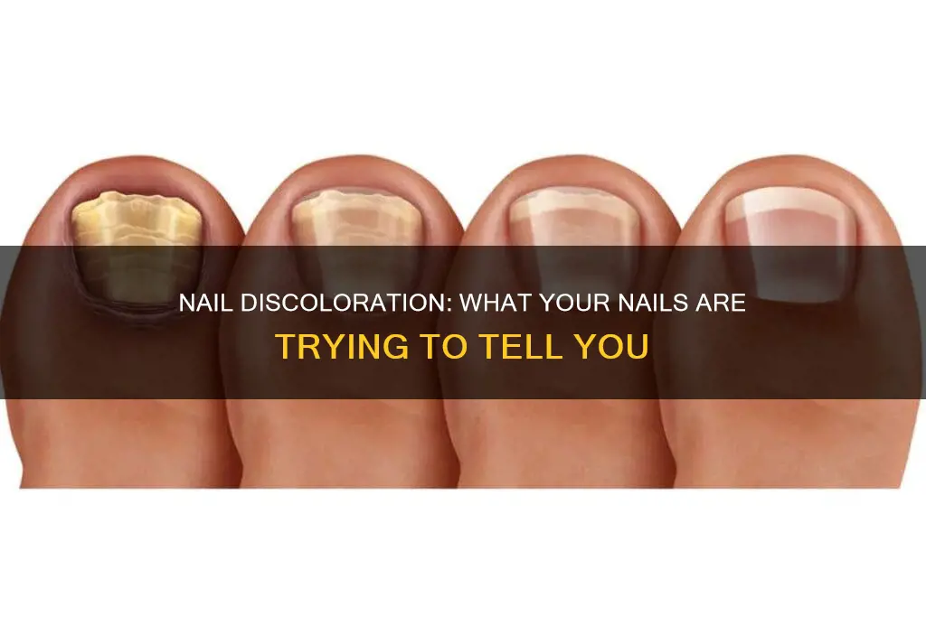 what does discolored nail mean