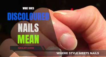 Unraveling the Mystery: Discolored Nails and Their Meanings