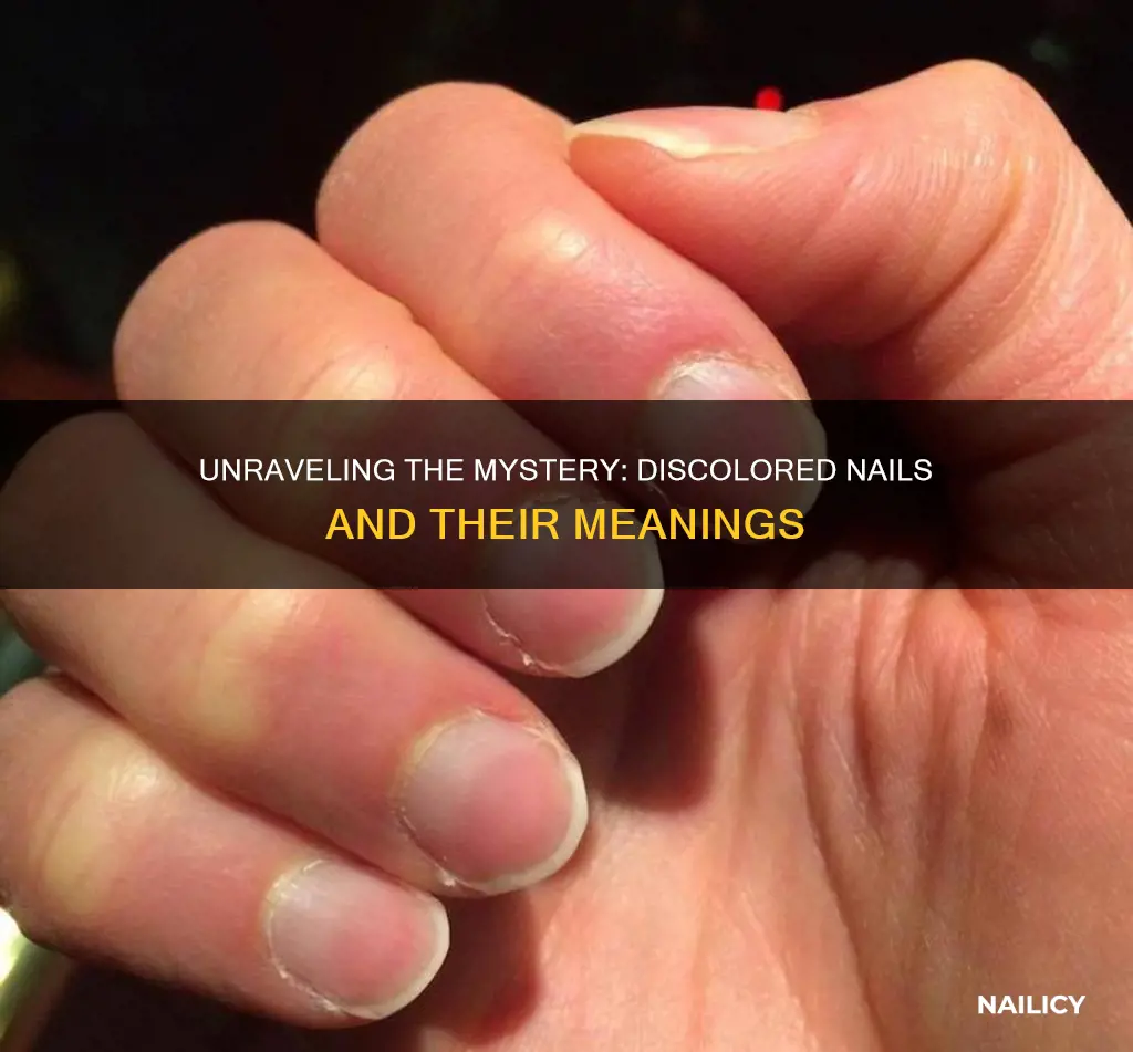 what does discoloured nails mean