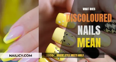 Discolored Nails: What Your Body Is Trying to Tell You