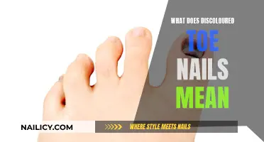 Unraveling the Mystery: Discolored Toe Nails and Their Meanings