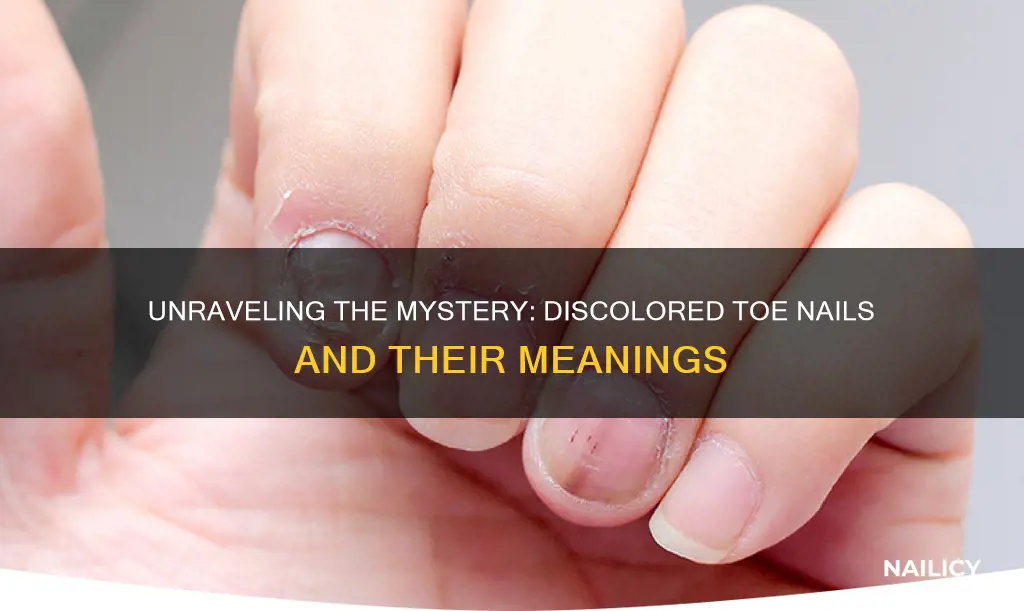 what does discoloured toe nails mean