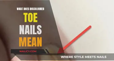 Toe Discoloration: What Your Nails Are Trying to Tell You