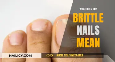 Brittle, Dry Nails: What Does It Mean?