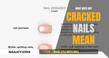 Unraveling the Mystery: What Your Nails Say About Your Health