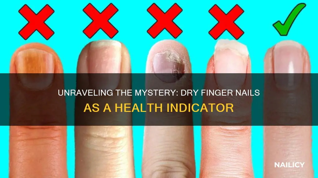 what does dry finger nails indicate