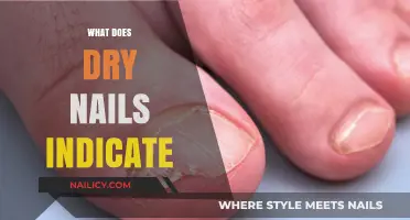 Decoding Dry Nails: What Your Nail Health Reveals About You