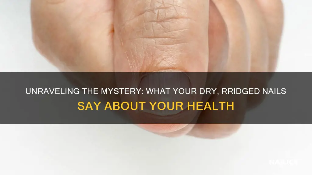 what does dry ridged nails mean