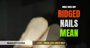 The Meaning Behind Dry, Ridged Nails: Know the Signs