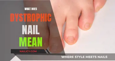 Understanding Dystrophic Nails: Causes, Symptoms, and Treatment Options