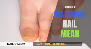 Dystrophic Nail: What Does It Mean?