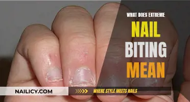 Understanding Extreme Nail Biting: Causes and Solutions