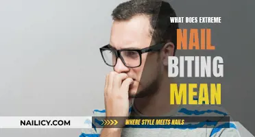 Nail Biting: What Does It Mean When It's Extreme?