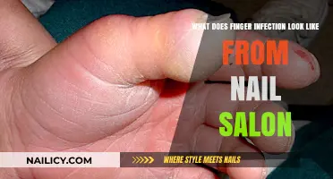 Nail Salon Infections: Recognizing Symptoms and Preventing Finger Infections