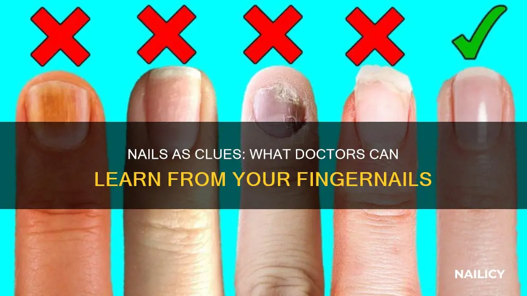 what does finger nails tell the dr