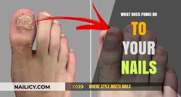 Fungal Nail Infections: Causes, Symptoms, and Effective Treatment Options Explained
