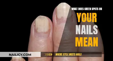 Green Spots on Nails: What Do They Mean?