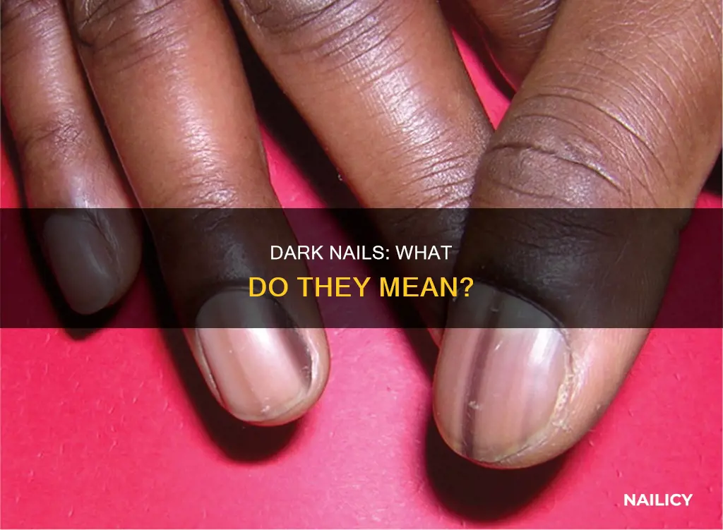 what does having dark nails mean