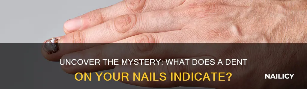 what does having dent on your finger nails mean