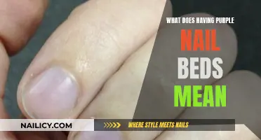 Purple Nail Beds: What Do They Mean?