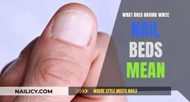 White Nail Beds: What Do They Mean for Your Health?