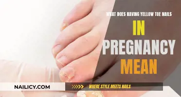Yellow Toe Nails: Pregnancy's Uncommon Warning Sign