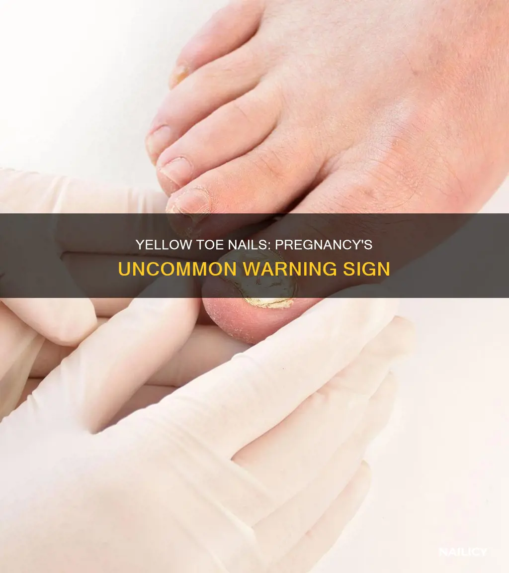 what does having yellow toe nails in pregnancy mean