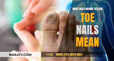 Unraveling the Mystery: What Your Yellow Toe Nails Say About You