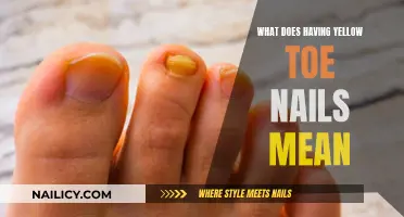 Yellow Toe Nails: What Do They Indicate?