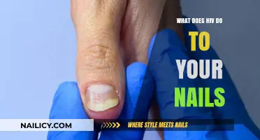 HIV and Nail Health: Understanding Symptoms, Changes, and Care