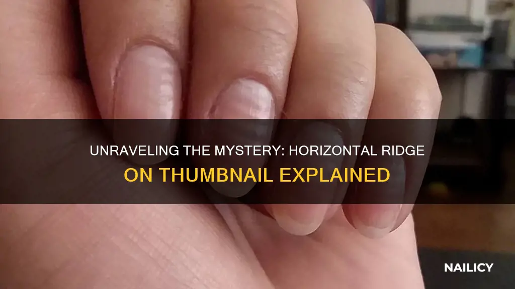 what does horisonal ridge in thumb nail mean