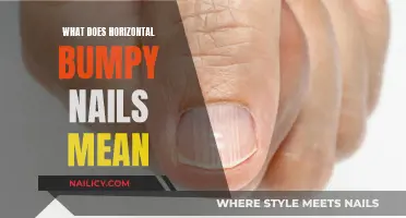 Unraveling the Mystery: What Causes Horizontal Bumpy Nails