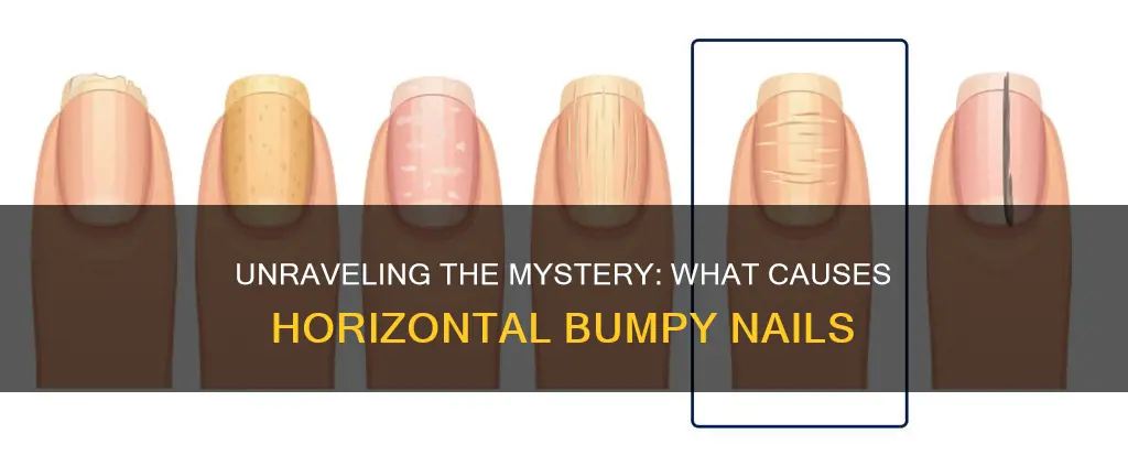 what does horizontal bumpy nails mean