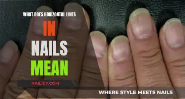 Horizontal Lines on Nails: What Do They Mean?
