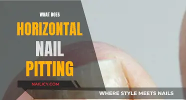 Decoding the Mystery: What Does Horizontal Nail Pitting Indicate?