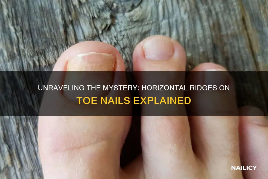 what does horizontal ridges on my toe nails mean