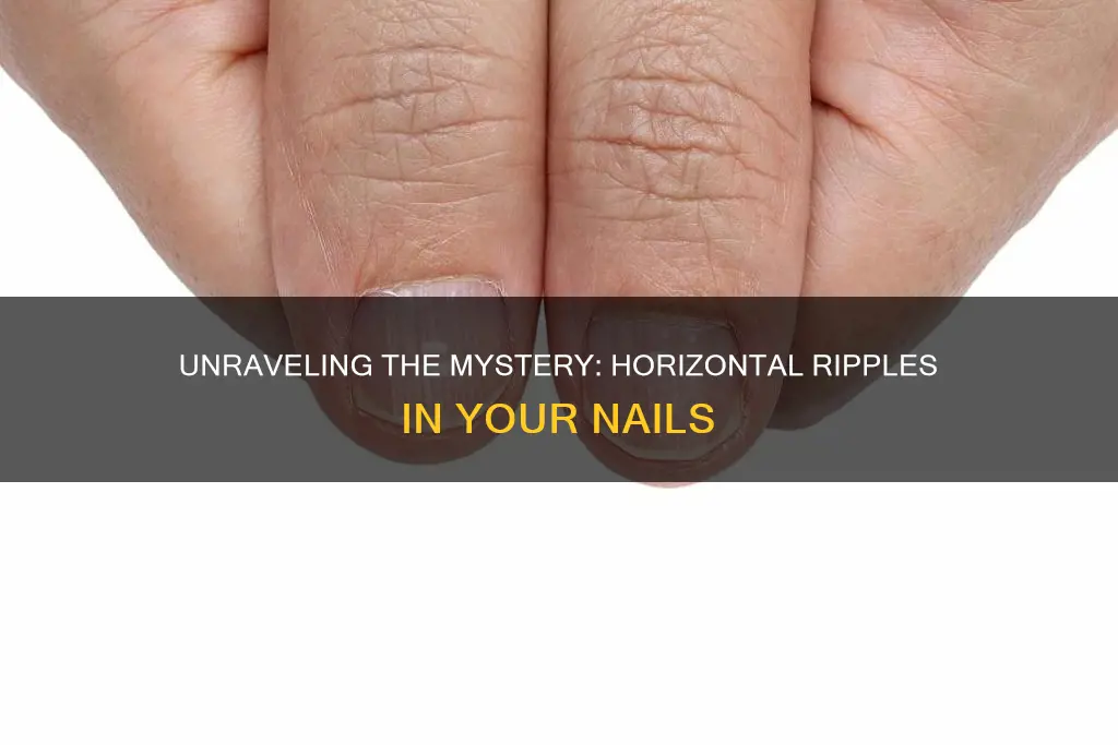 what does horizontal ripples in your nails mean