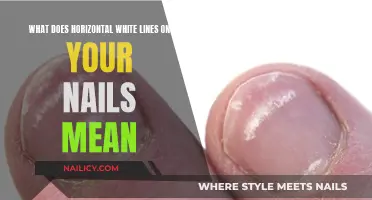 Unraveling the Mystery: Horizontal White Lines on Your Nails