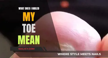 Toe Trauma: What Does "I Nailed My Toe" Mean?