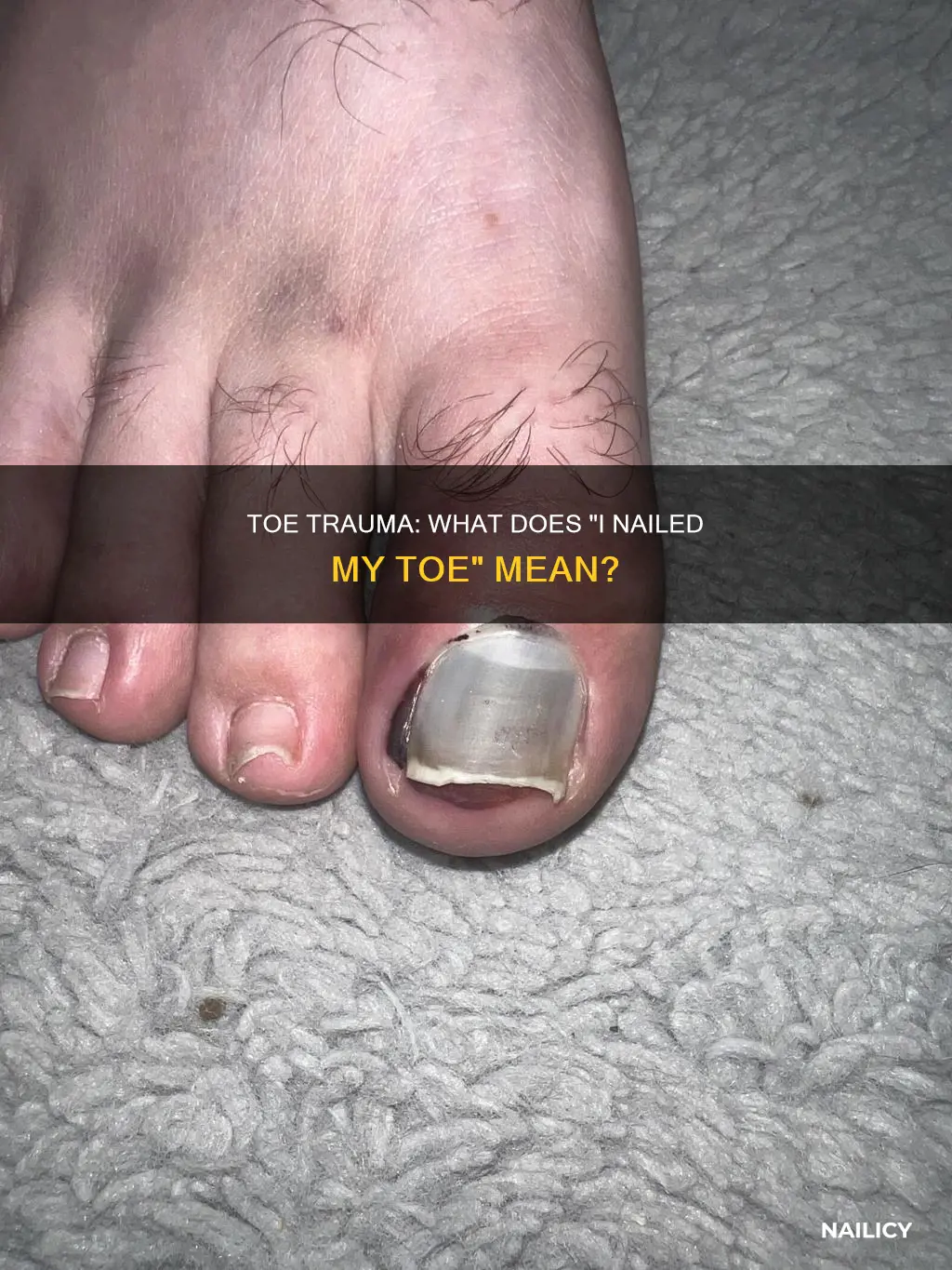 what does i nailed my toe mean