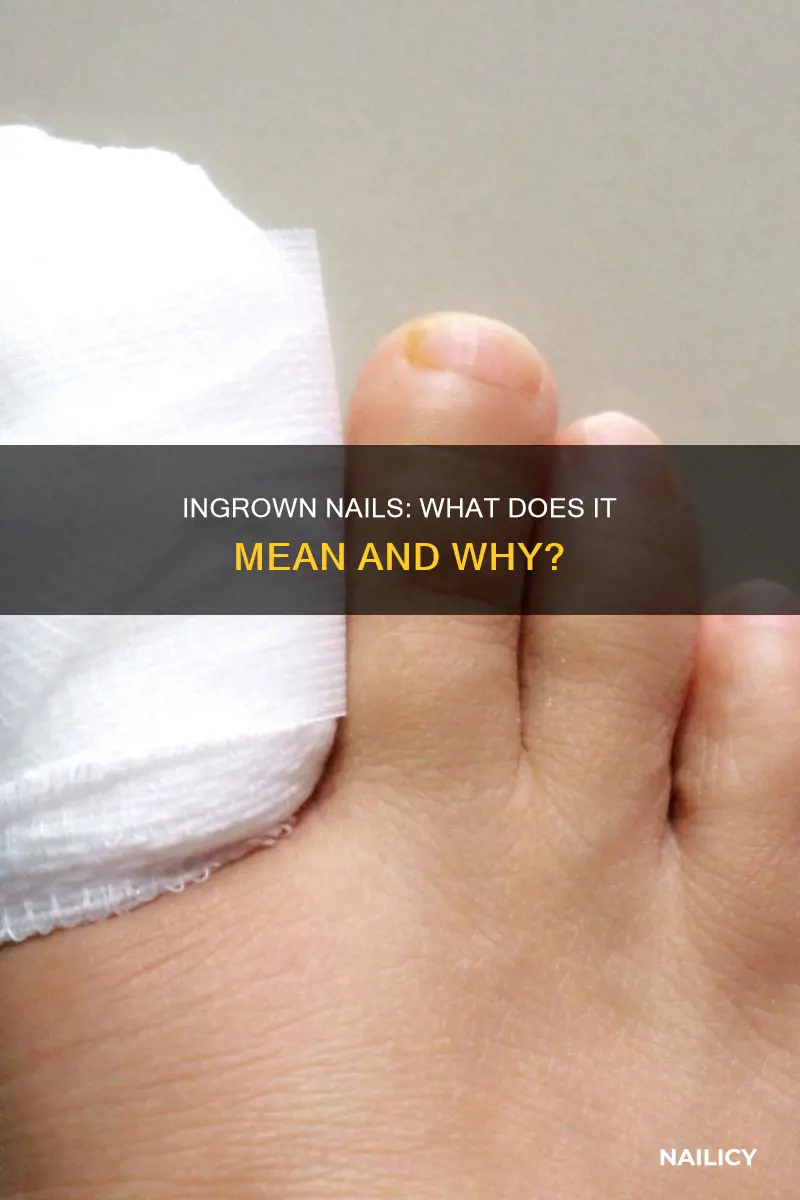 what does ingrown nails mean