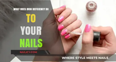 Iron Deficiency and Nail Health: Symptoms, Causes, and Solutions