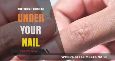 Unveiling the Hidden World: What Lies Beneath Your Fingernails