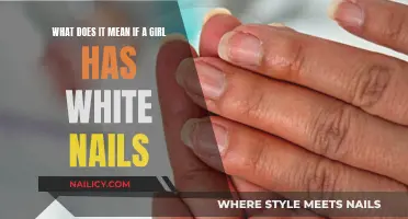 White Nails: A Sign of Health or Sickness in Girls?