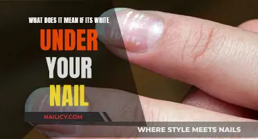 Nail Bed Discoloration: Understanding the Causes of White Underneath