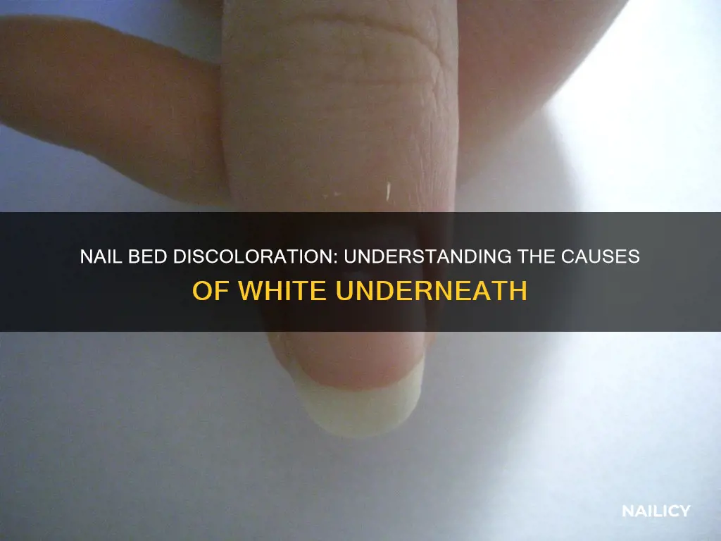 what does it mean if its white under your nail