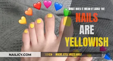 Yellowish Large Toe Nails: What Does It Mean?