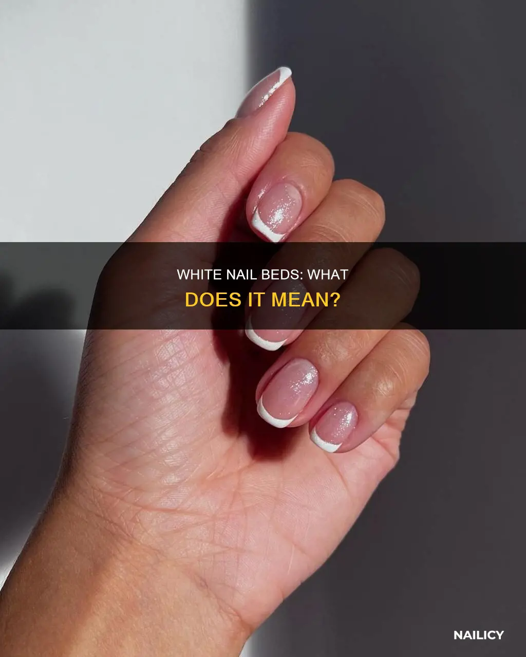 what does it mean if my nail beds are white