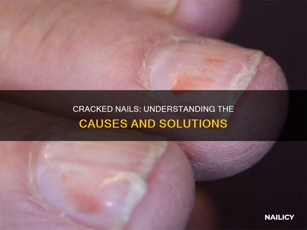 what does it mean if my nails are cracked